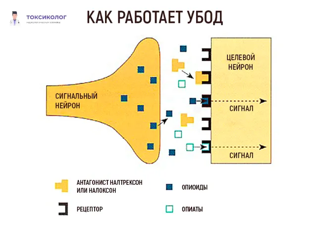 Как работает УБОД